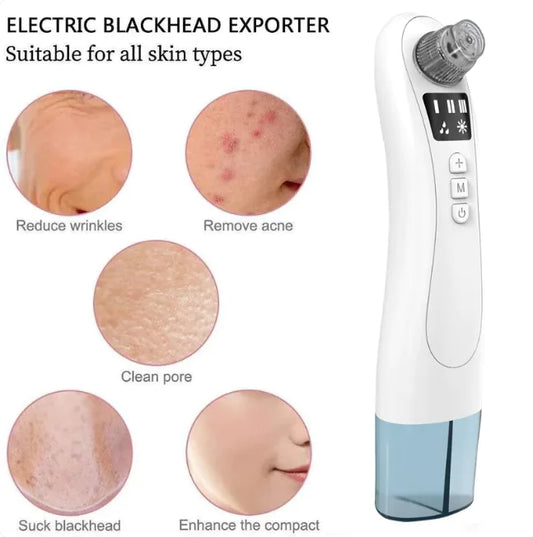 Clear Skin Electric Blackhead Remover