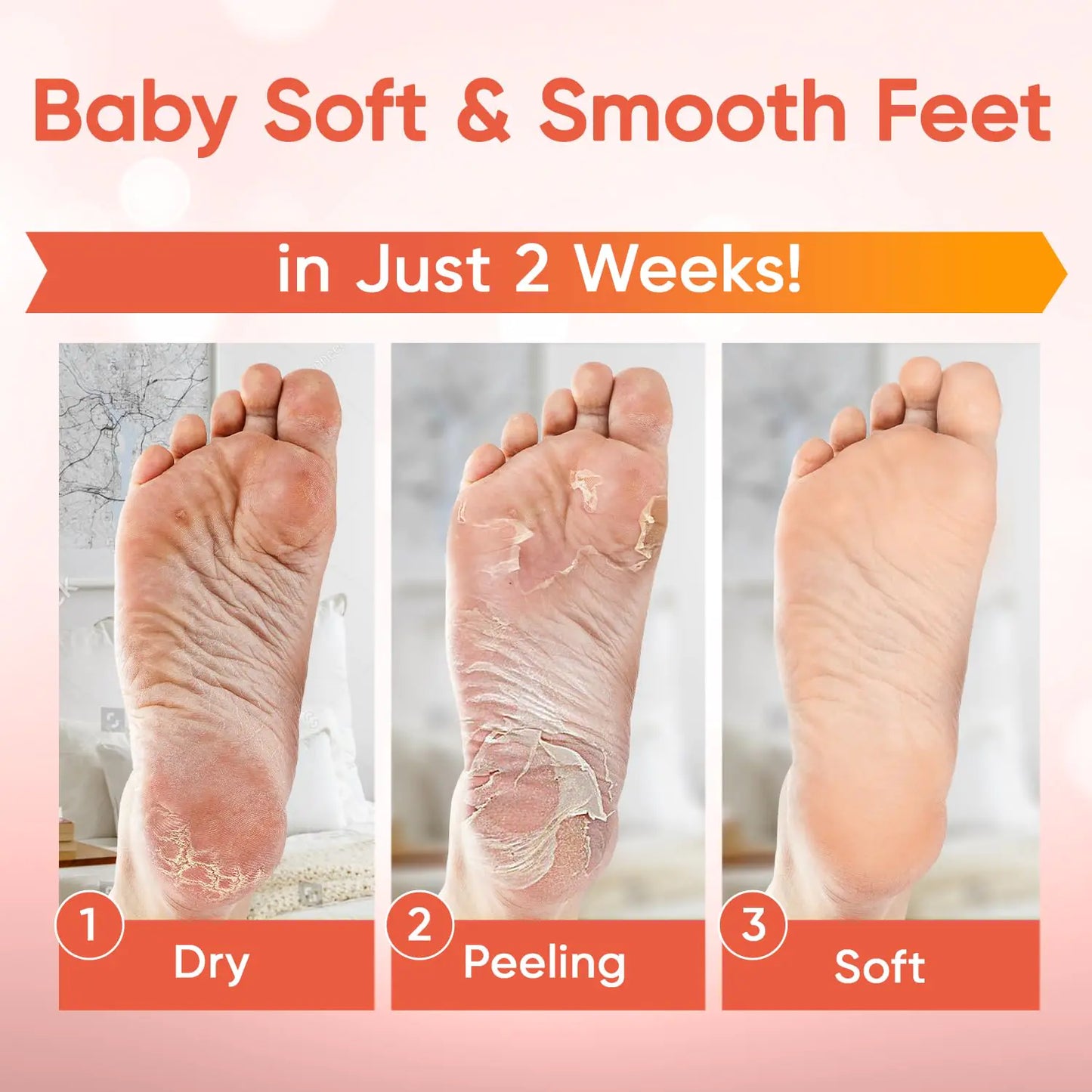 Foot Peel Mask (5 Pairs) - Foot Mask for Baby Soft Skin - Remove Dead Skin, Dry, Cracked Feet & Callus, Foot Spa, Made with Aloe Vera Extract for Women and Men Feet Peeling Mask Exfoliating, Peach 5 Pair (Pack of 1)